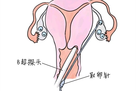 http://xian.vdtfzz.com/post/205.html|西安供卵助孕